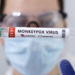 NCDC warns against monkeypox spread in Libya