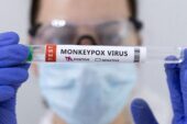 NCDC warns against monkeypox spread in Libya